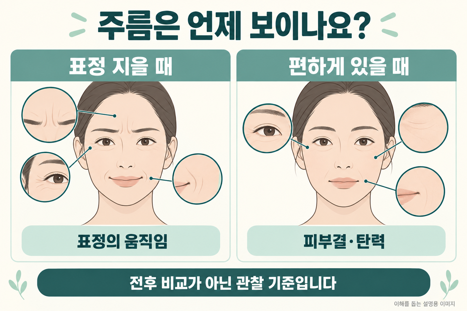 표정을 지을 때와 편하게 있을 때의 얼굴을 관찰해 표정 움직임과 피부결·탄력을 구분하는 설명 그림