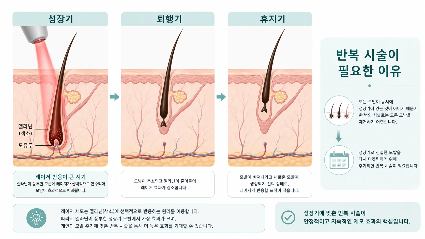 아포지플러스 레이저제모 칼럼 대표 이미지